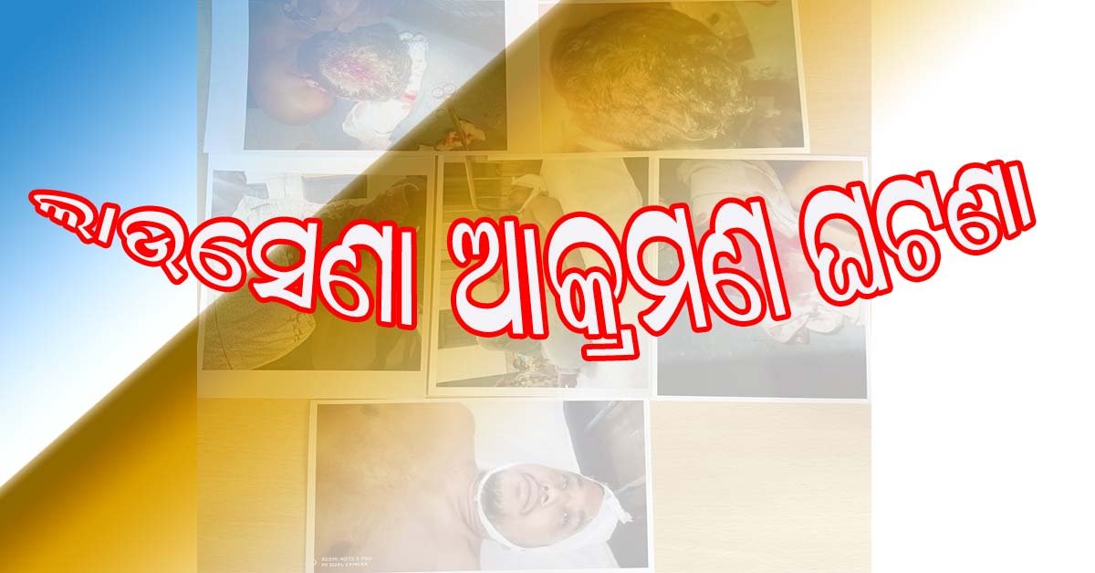 ଲାଉସେଣା ଦିବ୍ୟରଞ୍ଜନ ଆକ୍ରମଣ ମାମଲା : ପୋଲିସ ତଦନ୍ତ ଏବଂ ଡାକ୍ତର ରିପୋର୍ଟ କୁ ନେଇ ପ୍ରଶ୍ନ ଉଠାଇଲା କଂଗ୍ରେସ !!!
